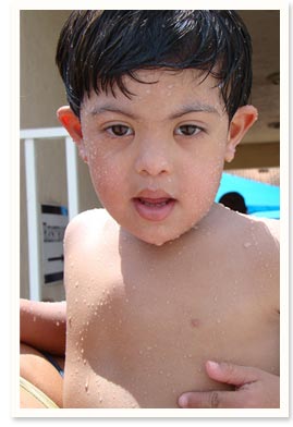 What Causes Autism | Autism Spectrum Disorder Causes